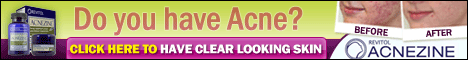 Acnezine Acne Skin Care Treatment